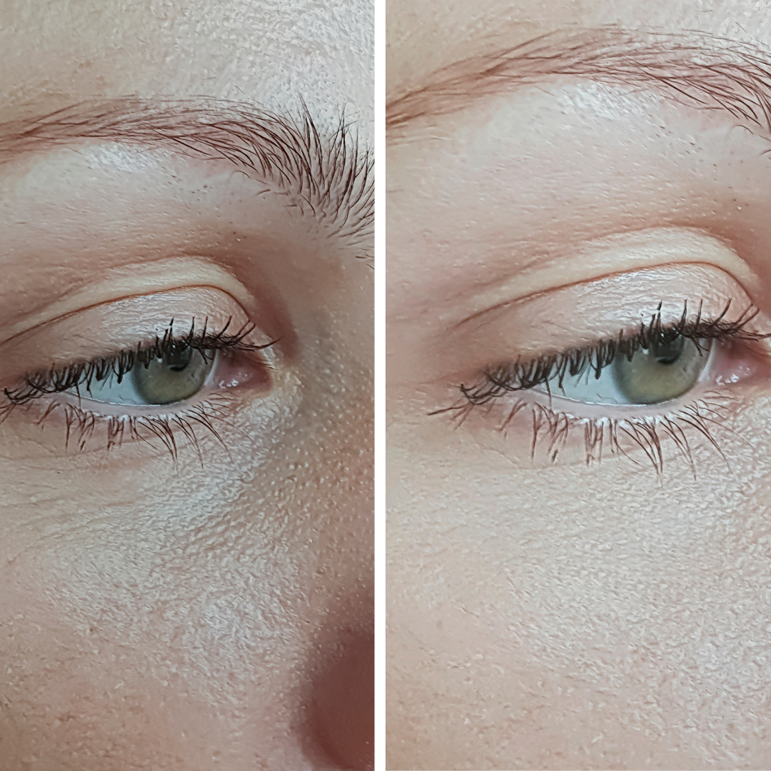 Serum Ojos - Antiinflamatorio Potenciado - Sualan Cosmetics