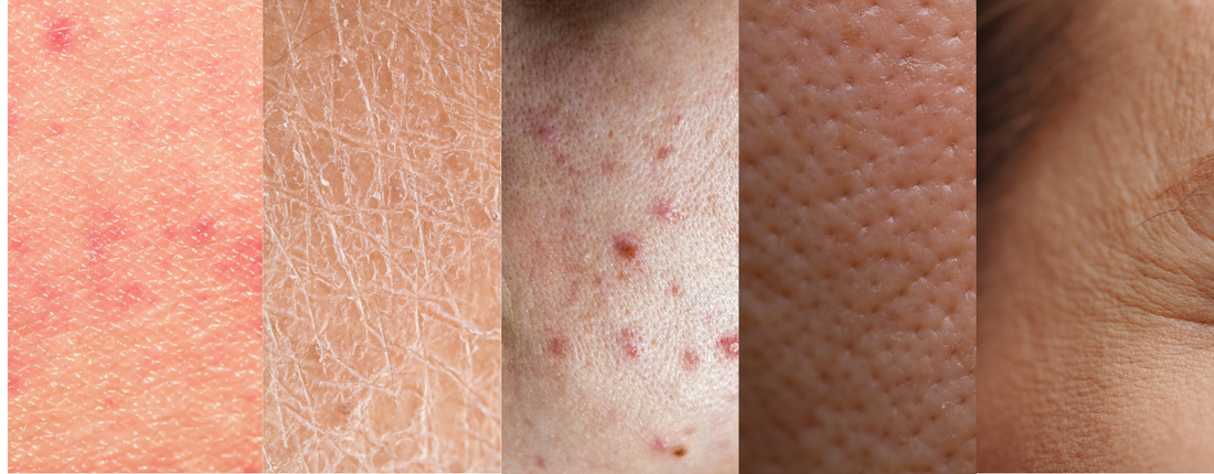 ¿Cómo detectar tu tipo de piel? - Sualan Cosmetics