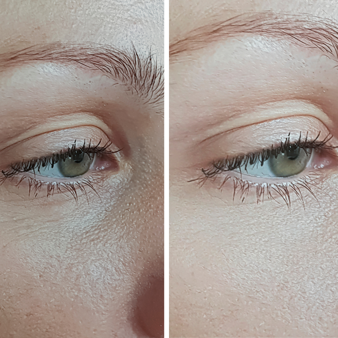 Serum Ojos - Antiinflamatorio y Revitalizante Natural